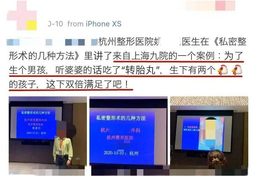 变性演变性演艺_汪欣蕾是变性人吗变性前照片资料_变性人